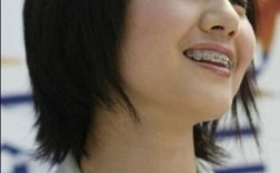 高圆圆矫正牙齿前图片曝光，牙齿状态究竟如何？