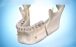 正畸治疗中骨头内部重建的具体过程是怎样的？