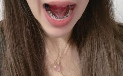 自己用舌头矫正牙齿
