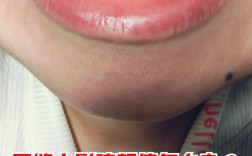 矫正前扩大牙缝的原因是什么？牙齿矫正为何需要这一步？