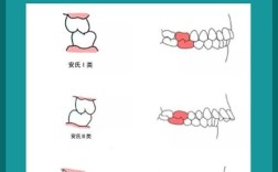 口腔正畸远中牙合关系矫正的关键策略有哪些？