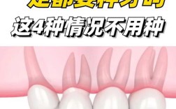 是否可以不用种牙