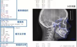 口腔正畸头颅侧位片