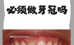 拜博口腔根管治疗保质