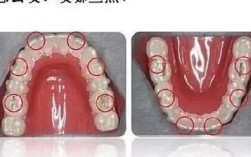 正畸胶边缘发黑是何原因？如何有效处理？