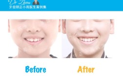 2025年北大口腔正畸