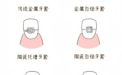 温州矫正牙齿的方法有哪些？不同矫正方式（如隐形、传统托槽、自锁托槽）分别适合哪些情况，价格和效果差异如何？