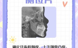 矫正牙齿要拍哪些片子？不同片子的检查重点是什么？