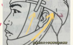 口腔矫治结扎方法如何选择与规范操作？