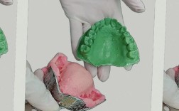 制取印模的方法有哪些？