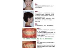 正畸面像拍摄技巧图片中，如何规范操作以获取清晰、全面的诊断影像？