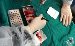 CGF临床应用方法的具体操作流程及不同适应症下的制备参数如何规范？