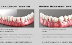 活动义齿与种植牙利弊