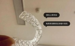 正畸咬合垫什么时候能去掉？去除前需要做哪些准备，医生会评估哪些因素？