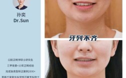 牙齿矫正不在中线