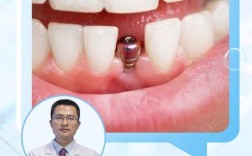 牙博士种牙水平