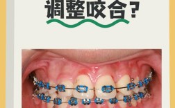 咬合矫正的最佳方法是什么？如何选择适合自己的方案？
