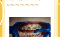 牙齿垫底方法有哪几种