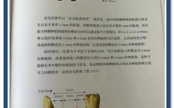 活动牙垂直距离确定方法有哪些？如何精准选择？