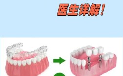 做正畸后能种牙吗