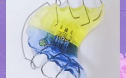 正畸螺旋扩弓器英文