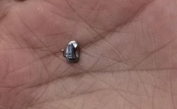 牙齿矫正后牙齿脱落？这是什么原因导致的？该如何处理？