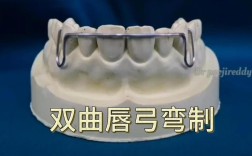 正畸双曲唇弓如何做