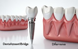 2025种植牙vs牙套最新区别，现在到底该怎么选？