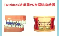 正畸Damon系统矫正效果如何？与传统矫正相比有何优势？