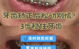 矫正期牙齿松动
