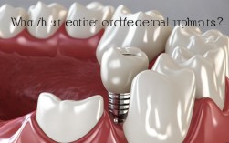 2025种植牙材料更新？哪种更安全耐用？