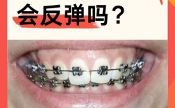 牙齿矫正反弹几率真的很大吗？