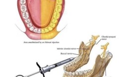 种牙麻醉要打几次？全过程需几次麻醉？