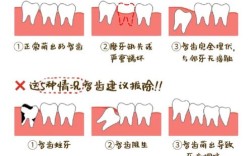 种牙必须拔牙吗？不拔牙能直接种吗？