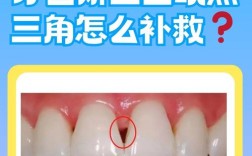 正畸根控 黑三角