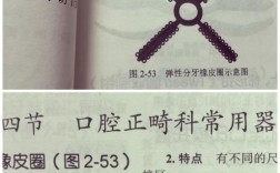 正畸带环左右上下标识如何区分？