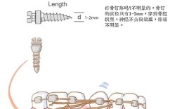 矫正打骨钉疼不疼？牙齿矫正骨钉植入痛感如何？
