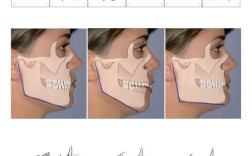 正畸说的高角低角