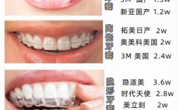 日本矫正牙齿费用大概需要多少钱？