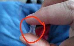 种牙后上颌窦感染？原因与应对方法需了解？