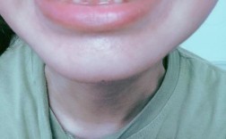 20岁后矫正牙齿，年龄会影响矫正效果吗？