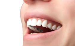 舌头和牙齿矫正