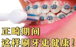 矫正牙齿刷牙视频