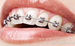 上海矫正牙齿去哪里？靠谱牙科机构怎么选？