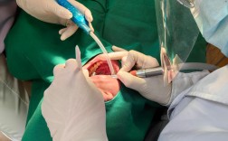 烤瓷牙拔掉做正畸