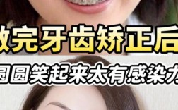 矫正牙齿后能改变笑容