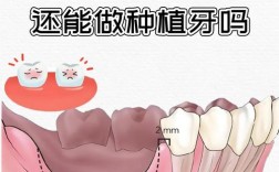 种牙选择自体骨移植时，取骨和种植过程会有哪些疼痛表现？术后疼痛程度如何有效缓解？