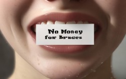 2025没钱矫正牙齿？年轻人有哪些最新平价方案？