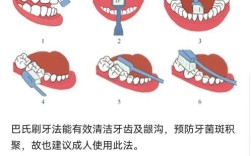 正畸期间刷牙，如何避免损伤牙套又清洁到位？
