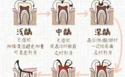 蛀牙如何自我治疗？家庭有效方法有哪些？